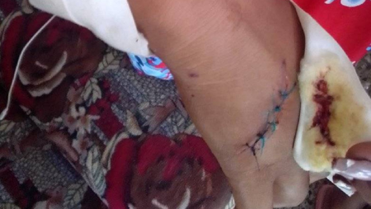 Hieren con arma blanca a mujer durante un asalto en Cojímar