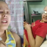 Piden ayuda para niña cubana con leucemia