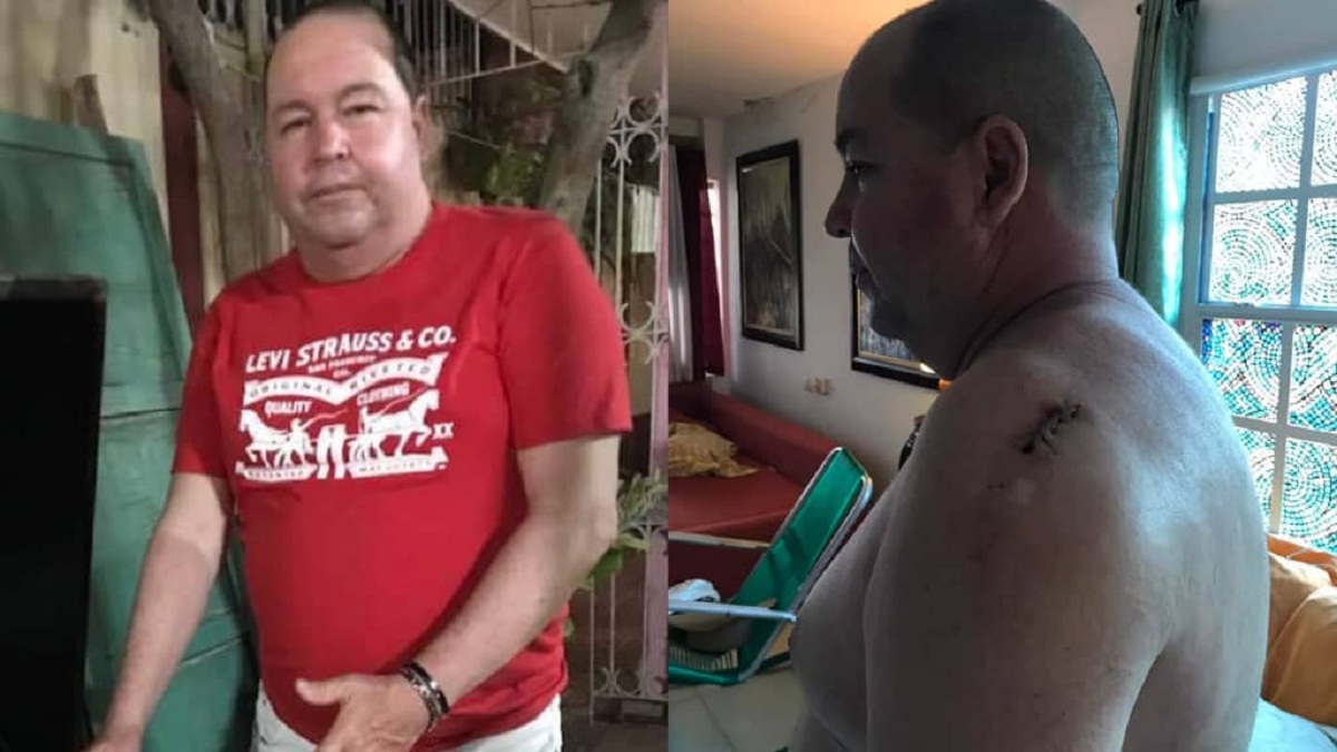 Delincuencia en Cuba: Apuñalan a un cubano para robarlo en Holguín