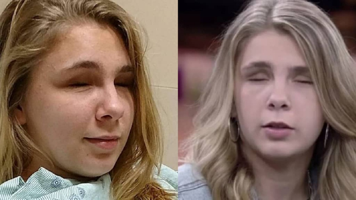 Joven sufre una alucinación tras una sobredosis de metanfetamina y termina arrancándose los ojos