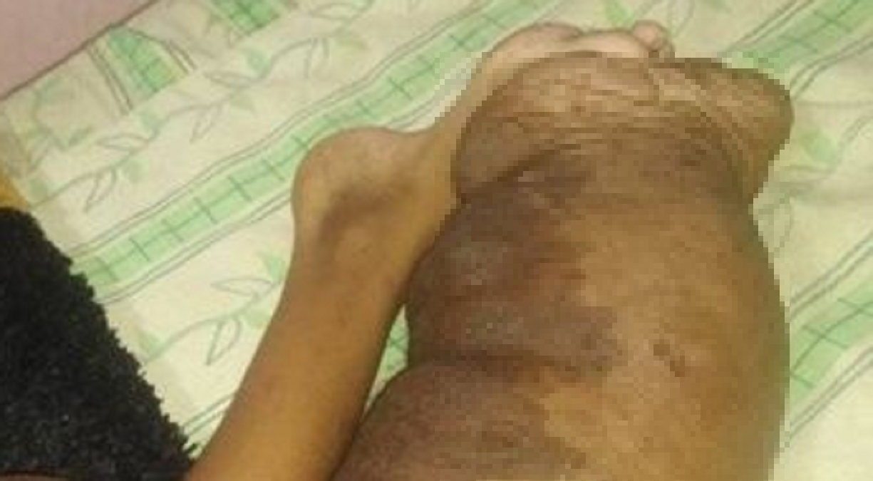 Abuela cubana exige atención medica para niña con enfermedad rara