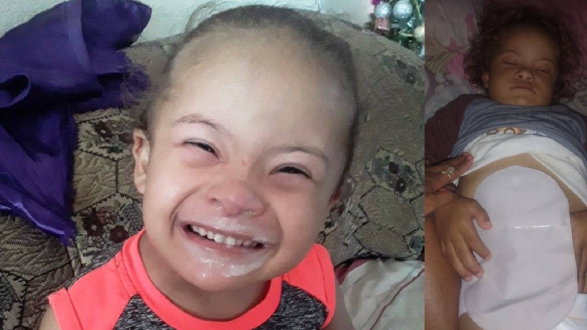 Piden bolsas de colostomía para niño cubano