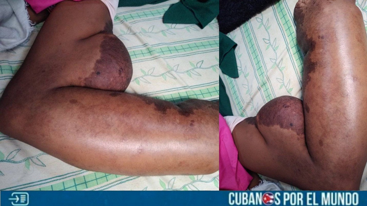 Piden respuesta del régimen ante "enfermedad congénita rara" de una niña en Cuba