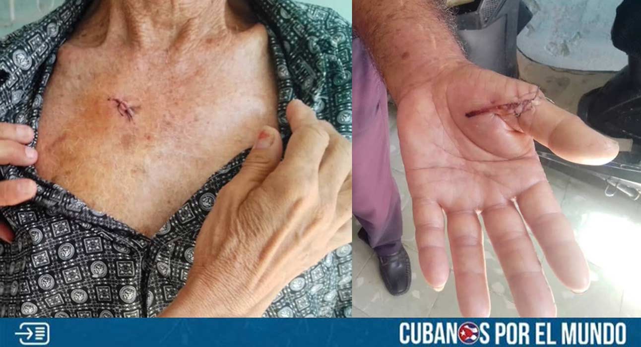 Un anciano en Holguín, Cuba recibió varias puñaladas en el momento en que delincuentes le robaron su bicicleta, evidenciando que los índices de delincuencia en la isla continúan en aumento.