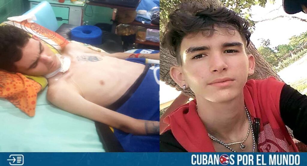 Joven atacado con machete en Holguín cumplió dos meses hospitalizado