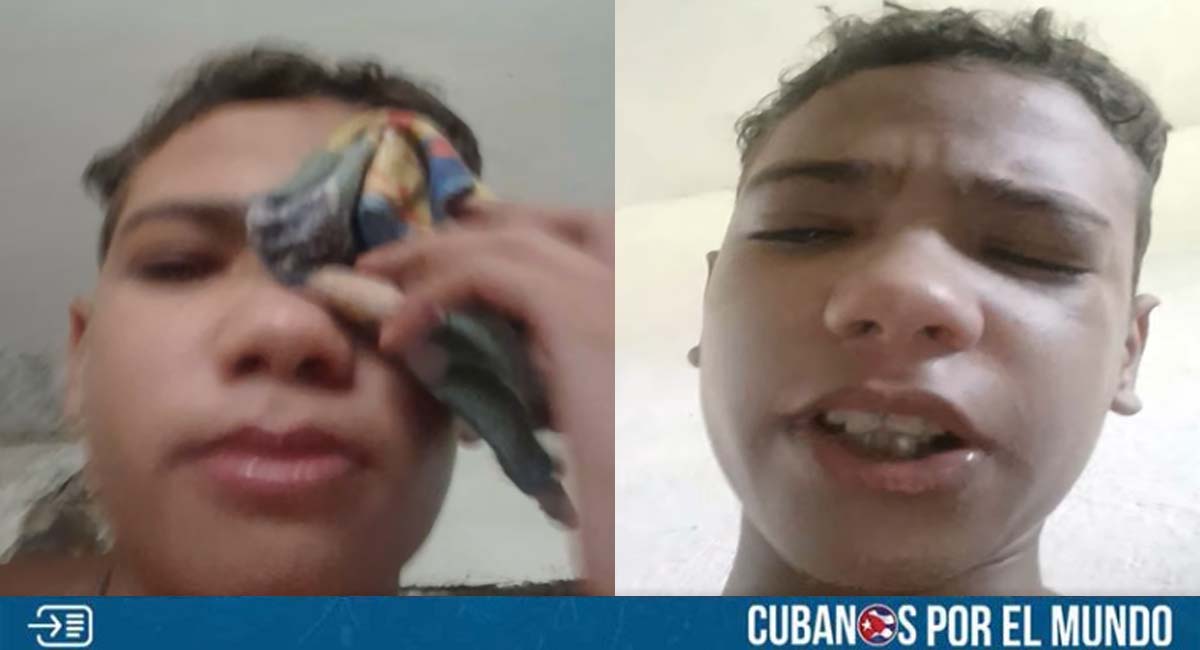 Pide ayuda desesperadamente y a escondidas, niño cubano que lleva tres años esperando por un trasplante de córnea