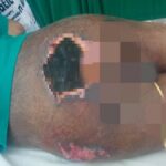 Piden medicamentos y colchón antiescaras para paciente postrado en Cuba