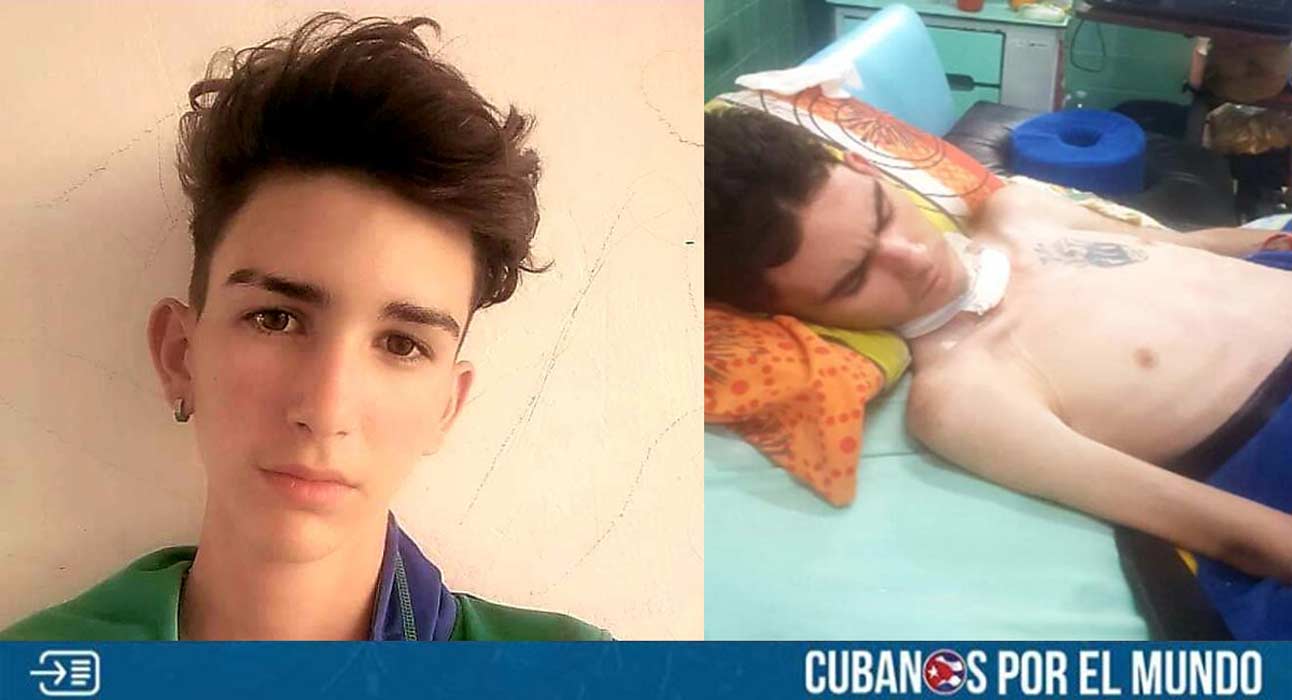El joven cubano Lester Domínguez, quien fue atacado en Holguín durante un robo, recibirá el alta médica el próximo viernes 16 de junio, según informó su padre, Dennis Domínguez en redes sociales este jueves.