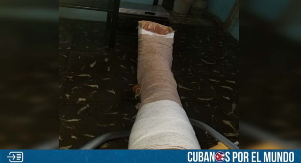 ¿Potencia médica? Inmovilizan pierna de una cubana con un pedazo de cartón