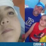 Piden ayuda para niño cubano con tumor cerebral: Necesita ser tratado en Miami
