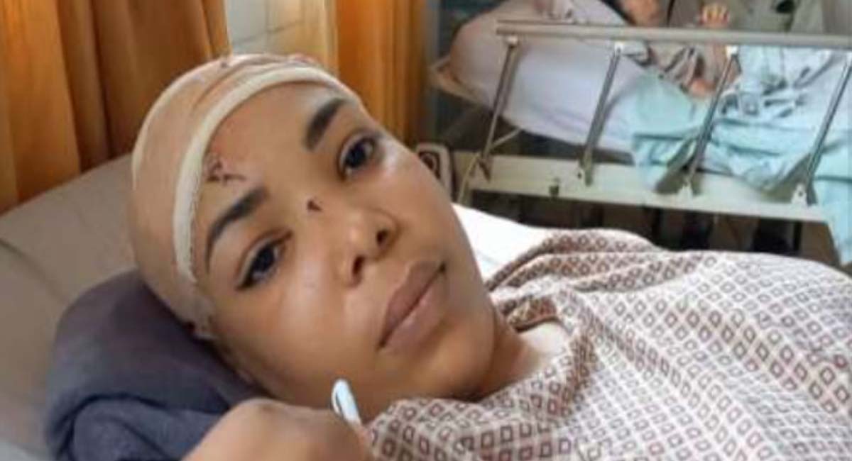 Cubana en Bolivia fue atacada a martillazos por su pareja