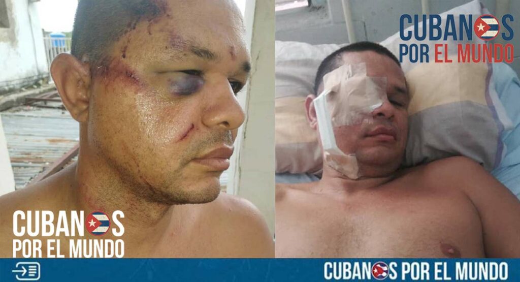 Un cubano que prefirió mantener su identidad bajo el anonimato denunció a la redacción de Cubanos por el Mundo el riesgo que corrió su vida tras ser atacado por unos ladrones que entraron a su casa para robarlo en la isla comunista.