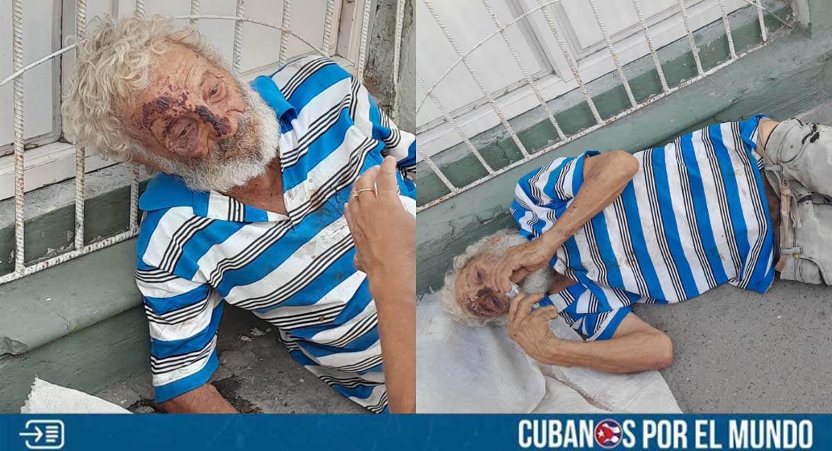 Anciano cubano con demencia es atendido tras caer en la calle