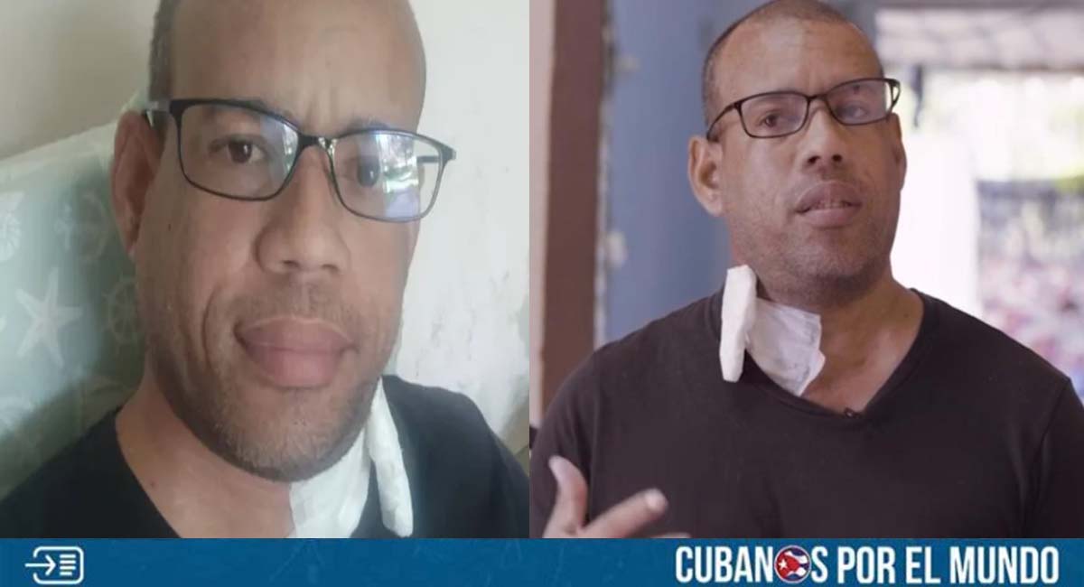 Piden ayuda para periodista cubano que necesita curarse en los Estados Unidos