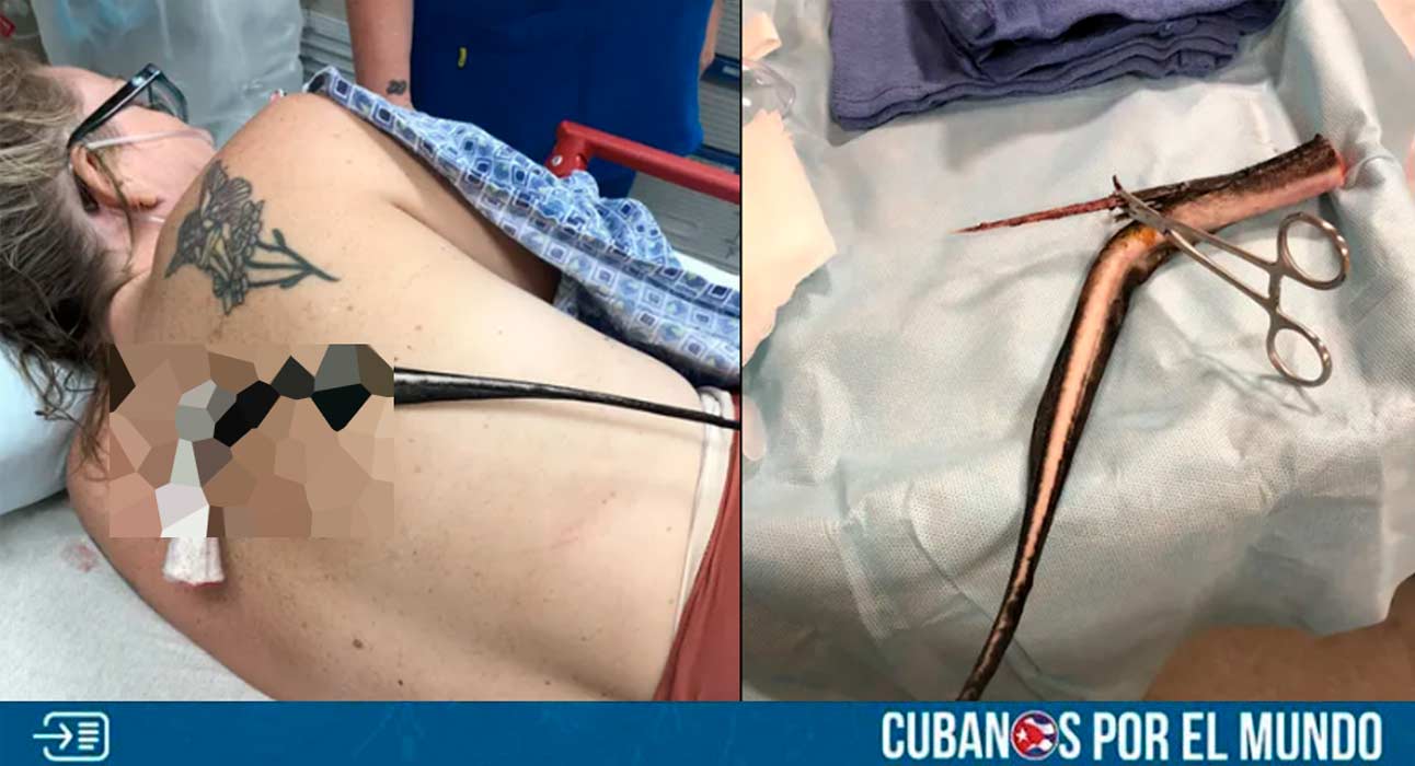 Una raya estuvo cerca de causarle la muerte a una mujer que se encontraba bañándose en una playa de Florida.