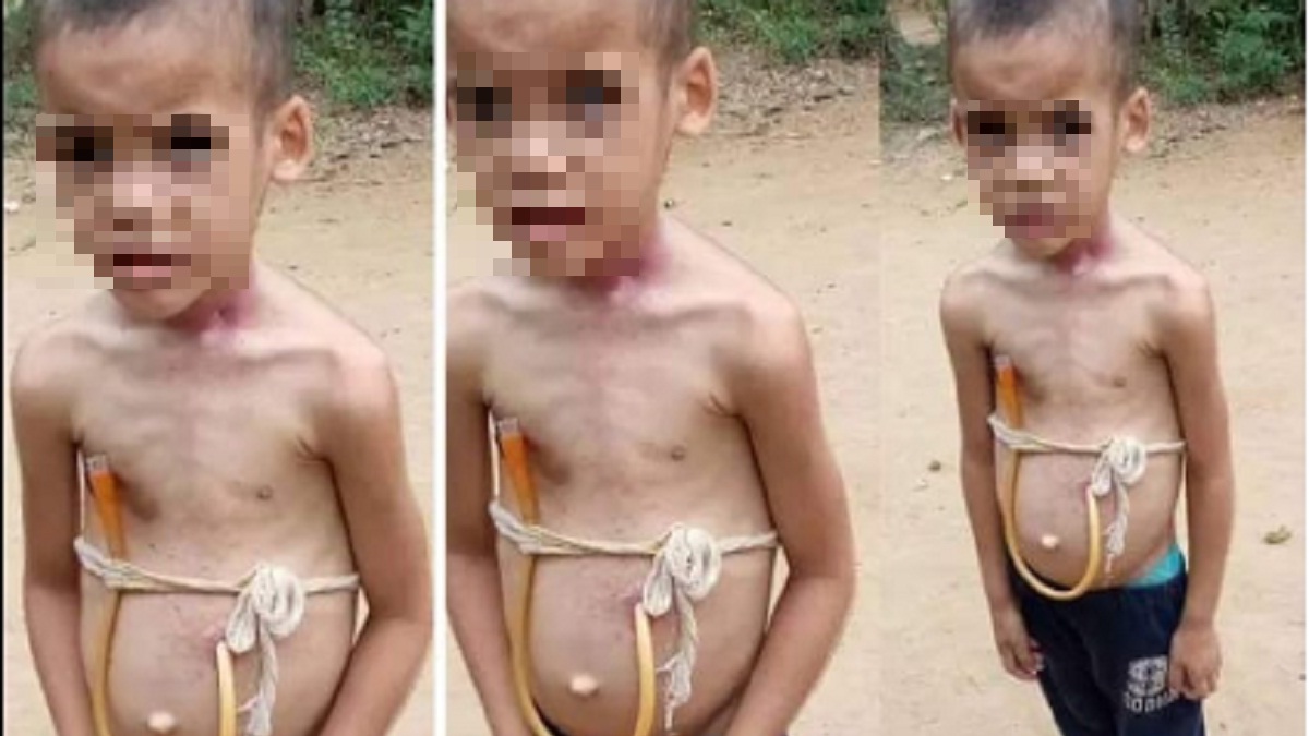 Claman ayuda para operar a niño huérfano en Cuba