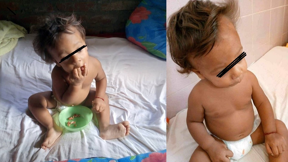 Piden ayuda para niño cubano: Necesita un andador