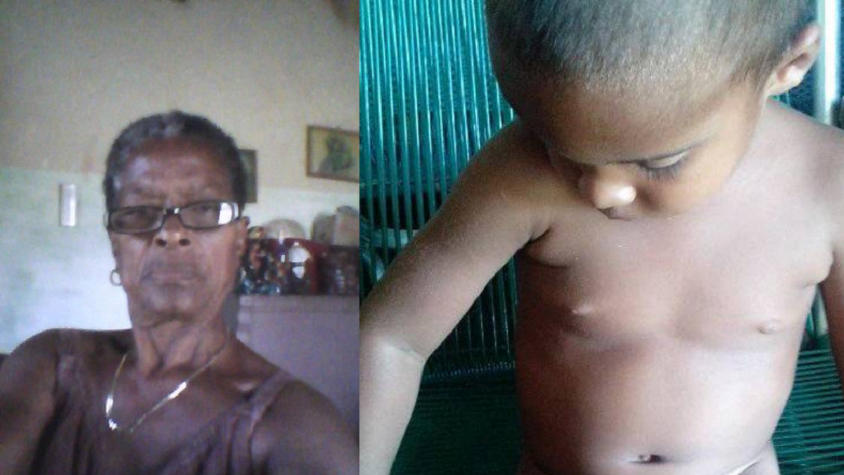 Abuela cubana exige operación de hernias para su nieto