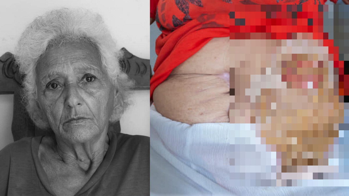 Anciana cubana enferma necesita ayuda en Pinar del Río