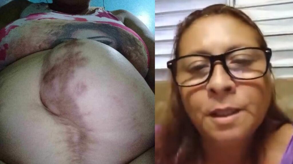 Cubana con múltiples enfermedades pide visa humanitaria para mejorar su calidad de vida