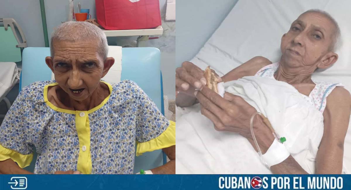 Anciana cubana que estaba sola en un hospital de La Habana fue operada con éxito