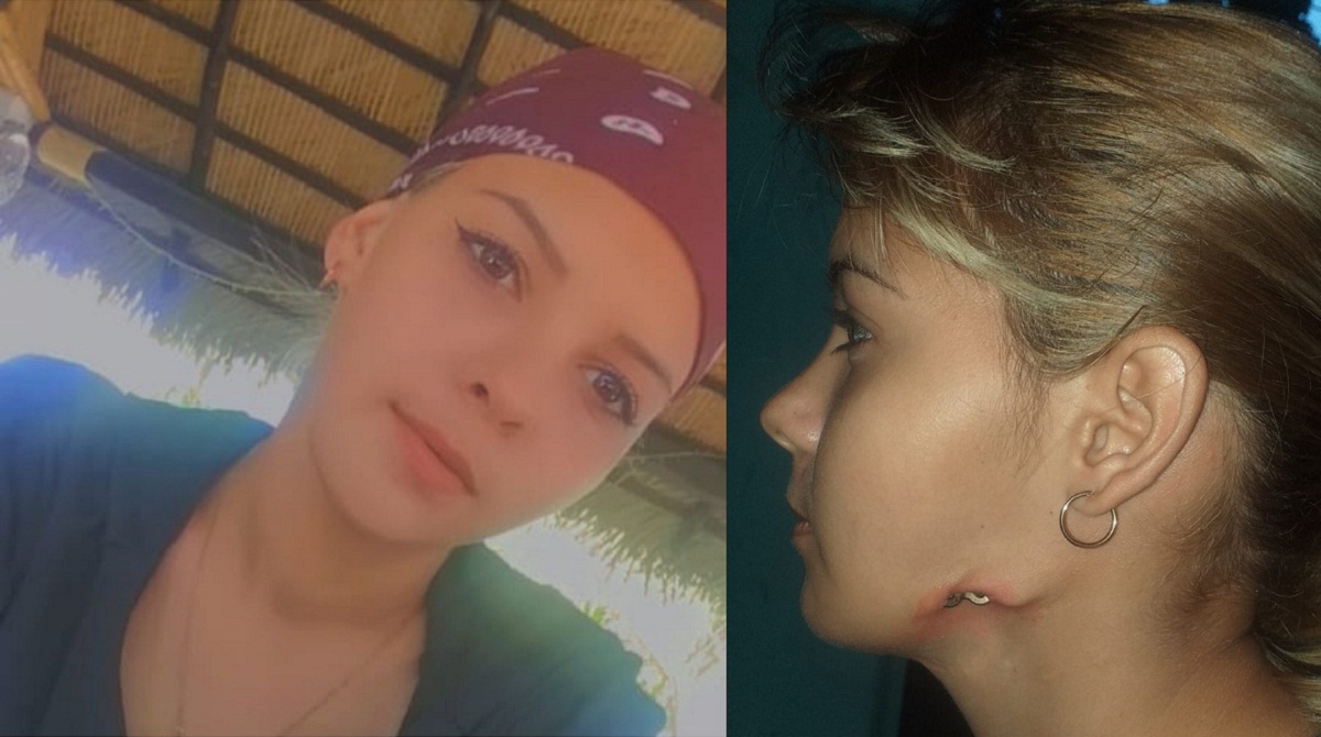 Piden ayuda para joven cubana que necesita una operación