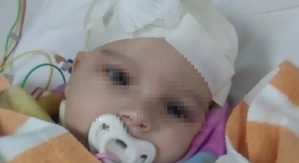 Operan finalmente a bebé con tumor en la cabeza tras divulgarse su caso en medios independientes y redes sociales