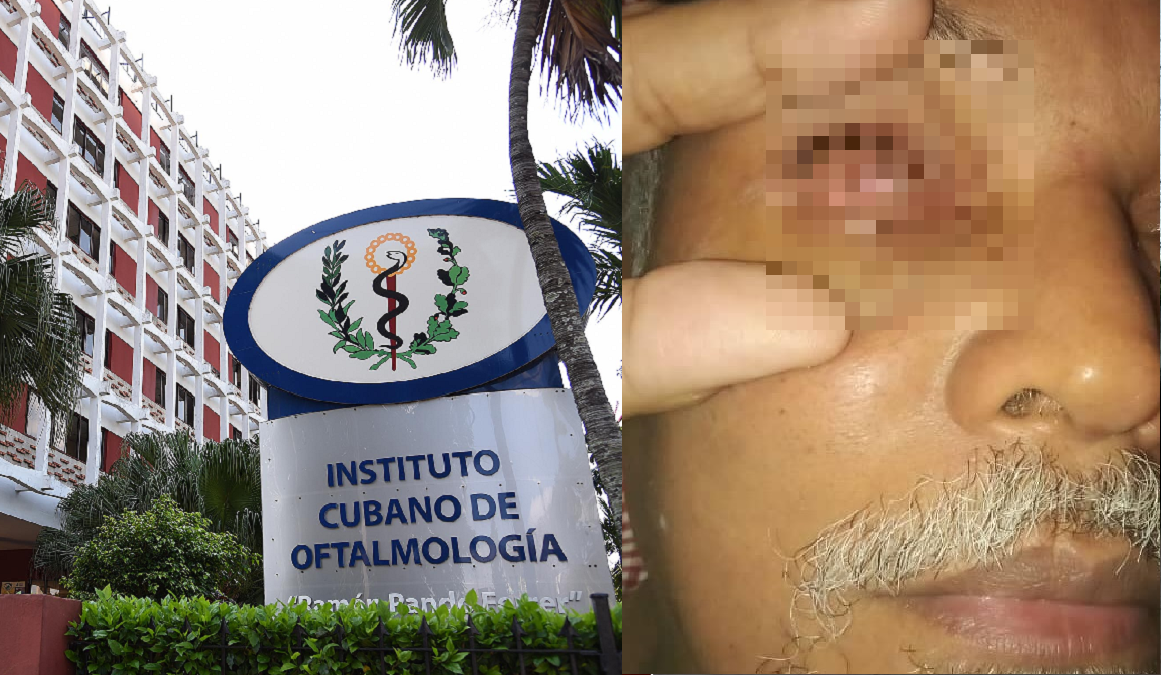 Denuncian que cubano queda ciego por culpa de la “potencia médica” y piden ayuda para él