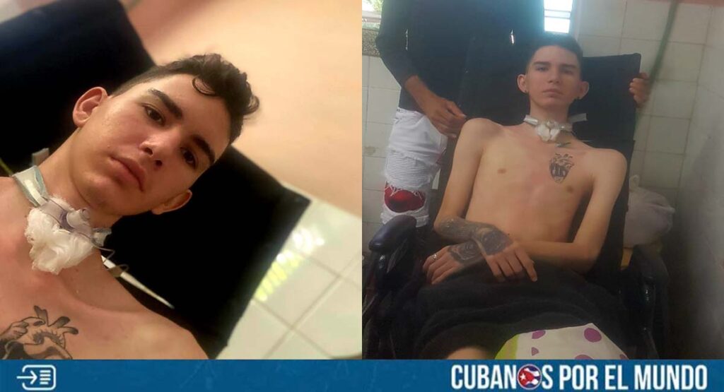 Joven cubano Lester Domínguez se mantiene con la traqueotomía