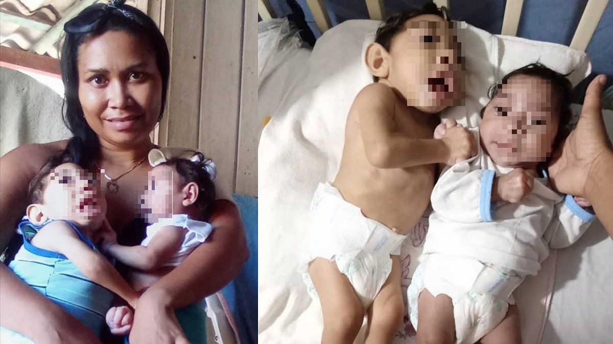 Madre cubana en Jiguaní necesita ayuda para sus hijos enfermos