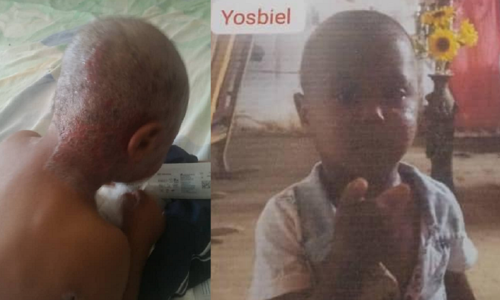 Piden medicamentos para niño cubano con enfermedad en la piel