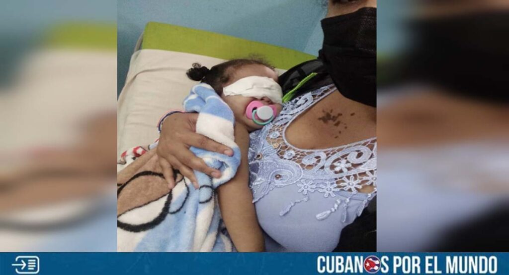 Niña cubana operada de cataratas congénitas necesita con urgencia unos espejuelos