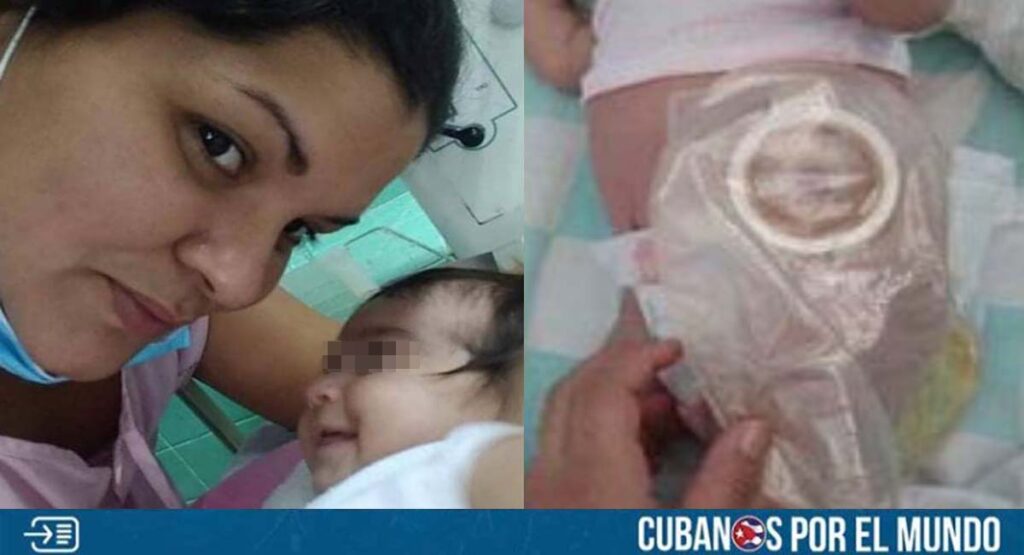 Piden ayuda para bebé cubana que necesita ser atendida en Estados Unidos