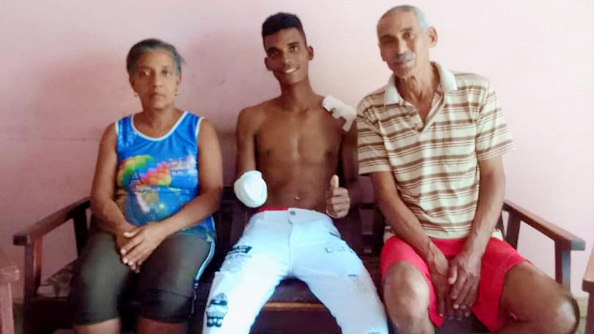 Joven mutilado por delincuentes en Santiago de Cuba recibe el alta médica