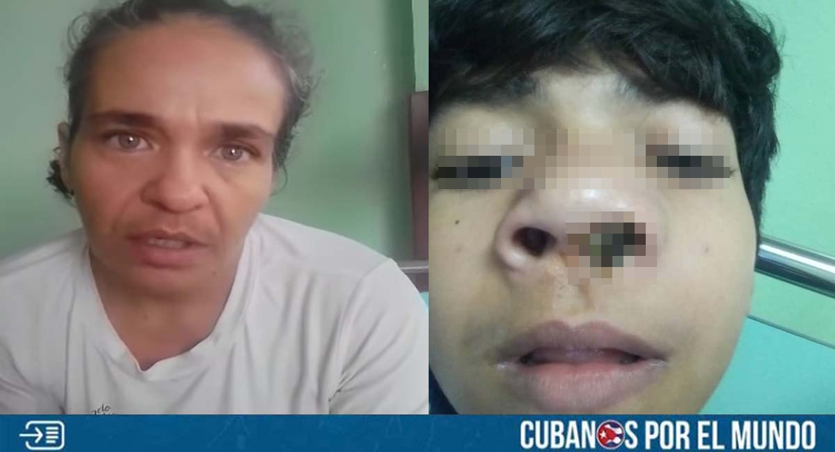 Madre cubana desesperada pide ayuda para su hijo con cáncer de nariz
