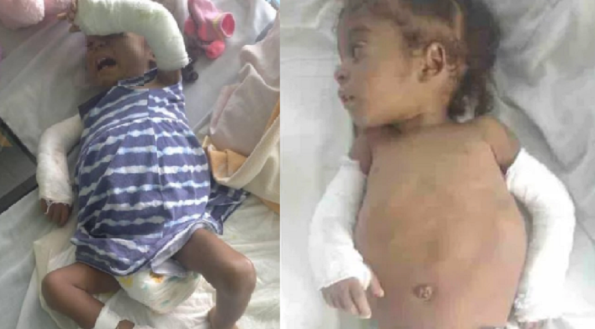 Gofundme por niña Amanda supera ya a los 12 mil 500 dólares