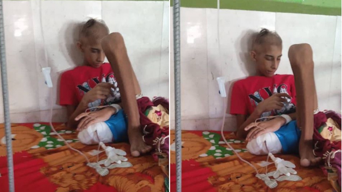 Piden ayuda para joven amputado en Holguín