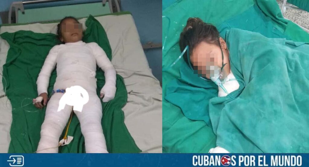 Dos niños son hospitalizados en La Habana tras accidente