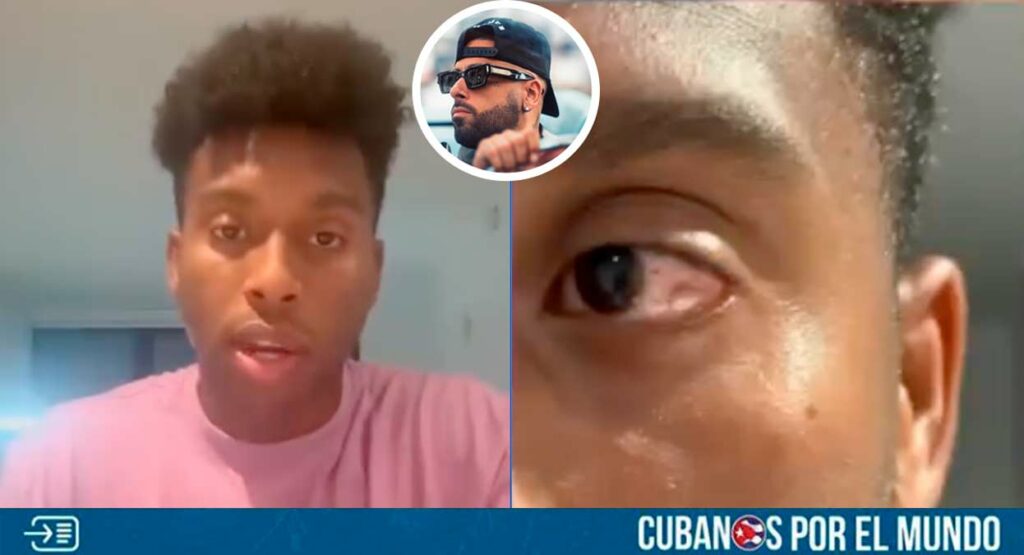 Un modelo cubano está acusando al reguetonero puertorriqueño Nicky Jam de haberlo agredido en una discoteca de Miami.