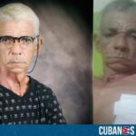 El activista cubano Nelson Álvarez “El Porfiao” sufrió un accidente de moto en la isla, por lo que varias de sus amistades están pidiendo ayuda para él en las redes sociales.