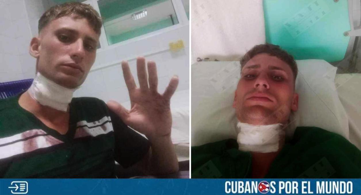 Un joven cubano fue atacado violentamente por otro para robarle su moto en Santiago de Cuba. Así lo dio a conocer el periodista independiente cubano Yosmany Mayeta Labrada, quien explicó que el agresor presuntamente es del mismo barrio del joven que resultó herido, quien responde al nombre de Leonel Camacho.