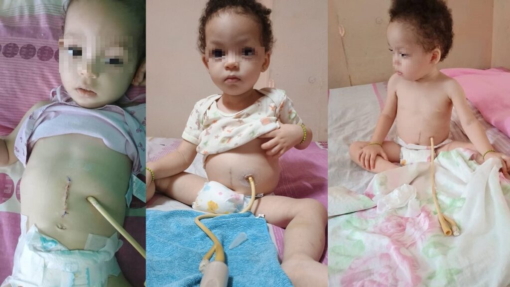 Piden visa humanitaria para niña cubana operada de gastrectomía esofágica