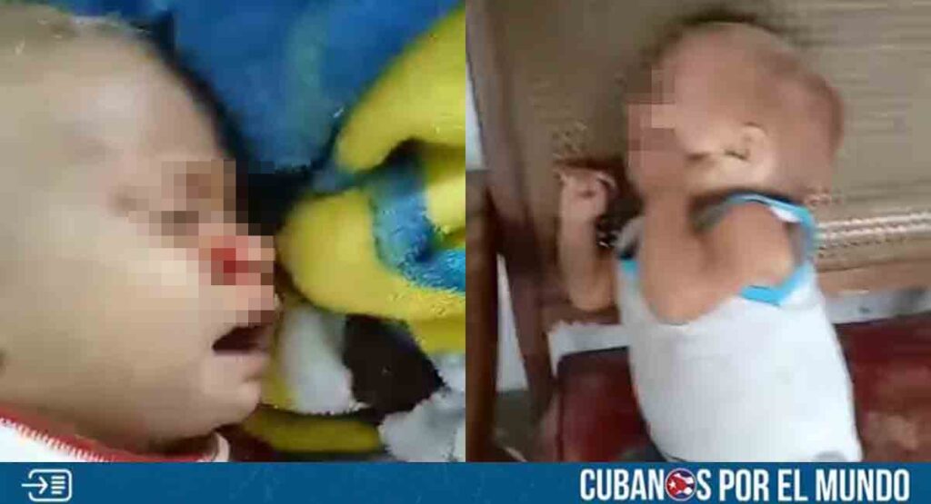 Piden ayuda para niño cubano que necesita un trasplante de hígado