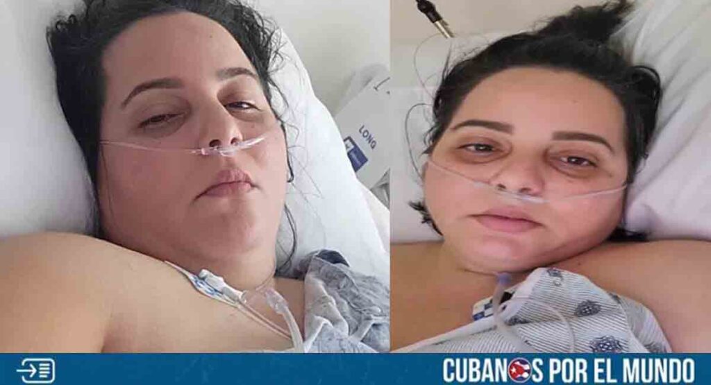 Cubana en Miami con enfermedad en la piel pide ayuda desesperada