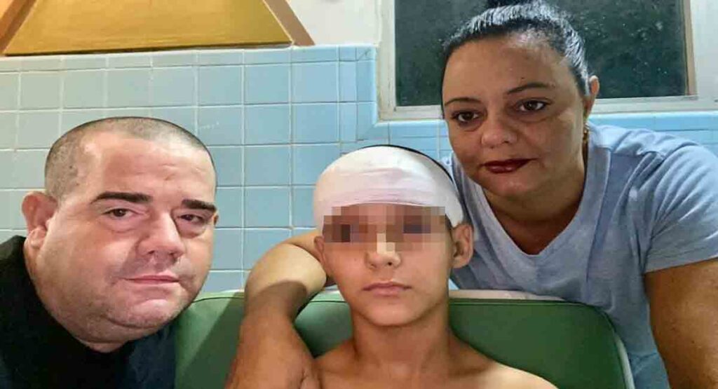 Niño de Sancti Spíritus sobrevive a una terrible herida en la cabeza provocada por un columpio