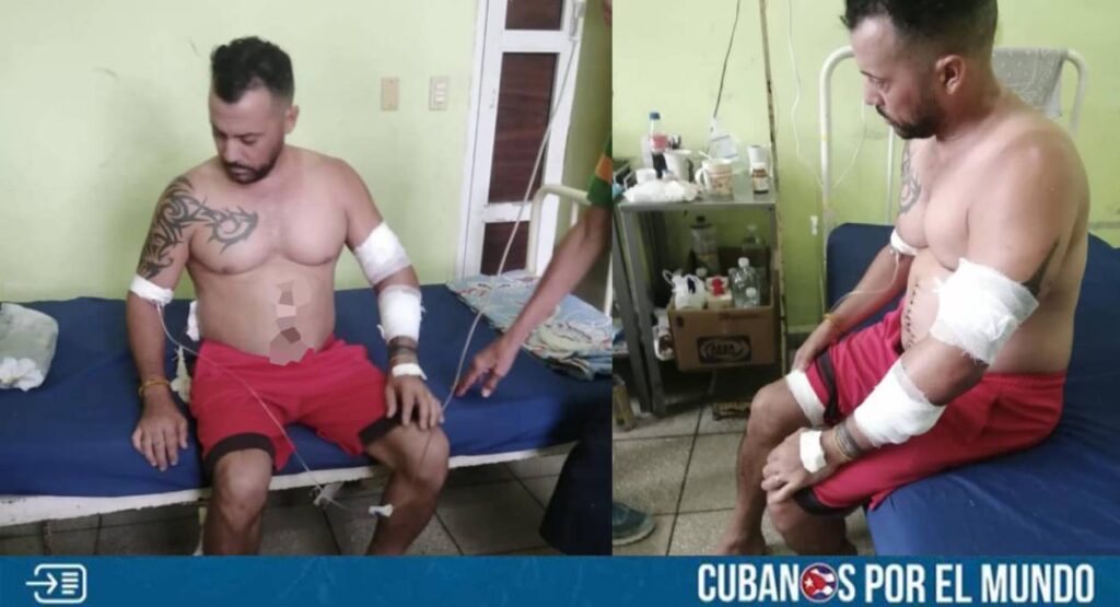 La delincuencia continúa desatada en la isla comunista, y este fin de semana se conoció el caso de un expelotero cubano que sufrió un brutal asalto en La Habana.