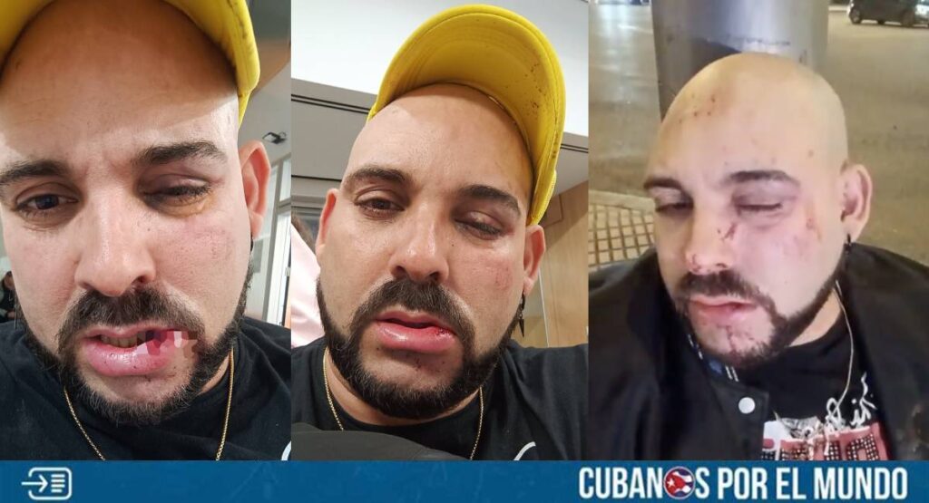 El activista cubano Lázaro Mireles, radicado en España, denunció que, fue víctima de una brutal agresión la noche del lunes de parte de aproximadamente ocho personas.
