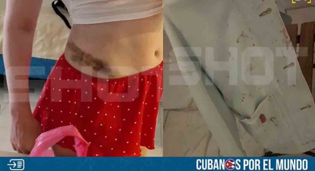 Reportan asalto violento a turistas rusas en La Habana