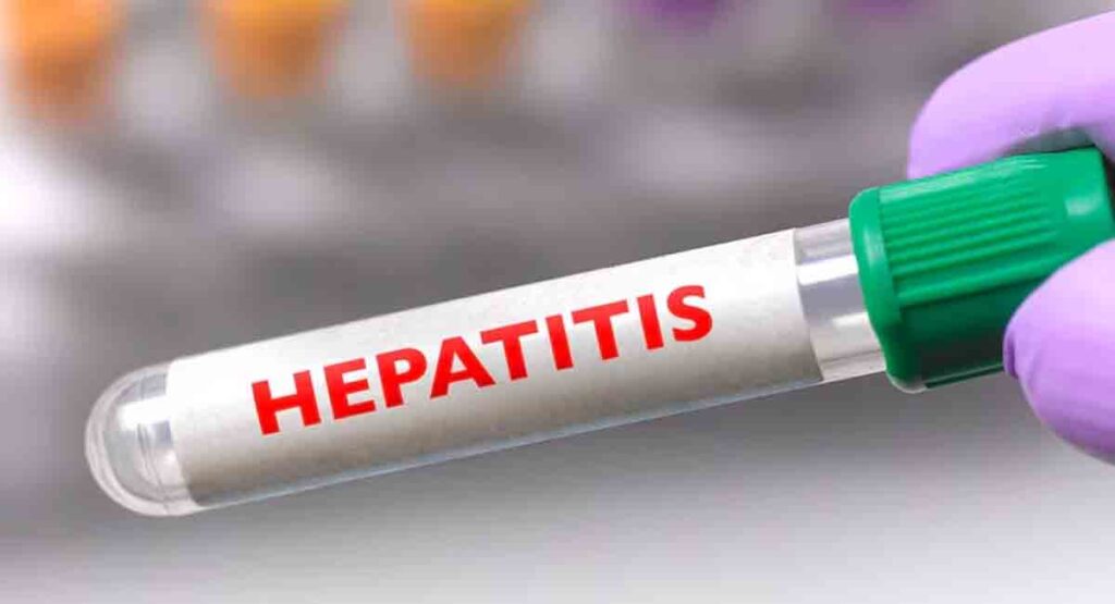 Brote de hepatitis genera preocupación en Matanzas