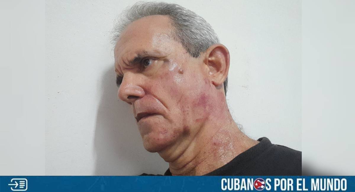 El escritor cubano Jorge Fernández Era denunció haber sido víctima de una violenta agresión física por parte de un oficial de la Seguridad del Estado en la unidad policial de Zanja, en La Habana, tras ser detenido el pasado viernes.